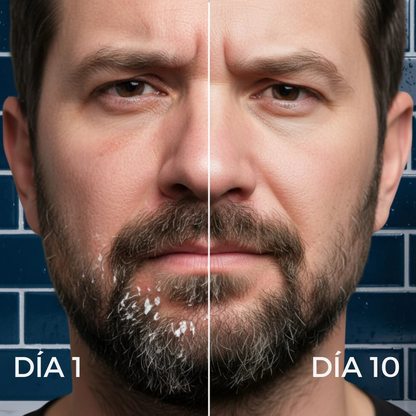 NEW AURA - Crema para Barba y Rostro. Chau a la Caspa, el Picor y la Irritación.
